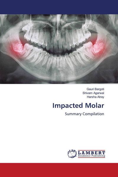 Produktbild: Impacted Molar