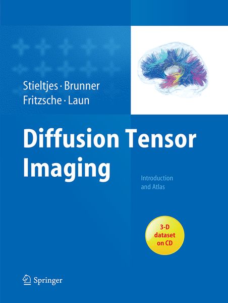 Produktbild: Diffusion Tensor Imaging