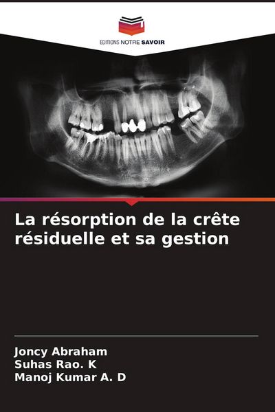 Produktbild: La r&eacute;sorption de la cr&ecirc;te r&eacute;siduelle et sa gestion