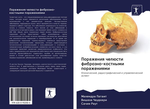 Produktbild: Porazheniq chel&uuml;sti fibrozno-kostnymi porazheniqmi