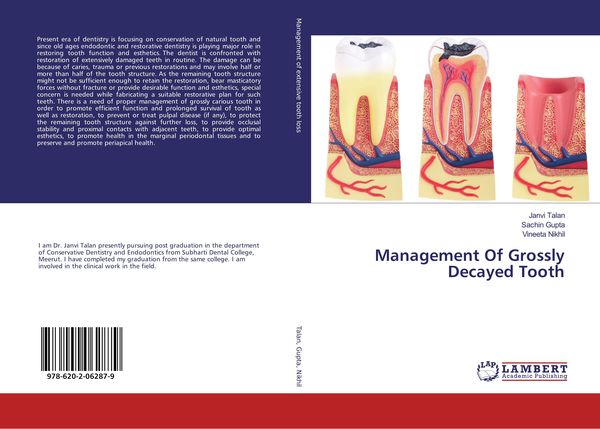 Produktbild: Management Of Grossly Decayed Tooth