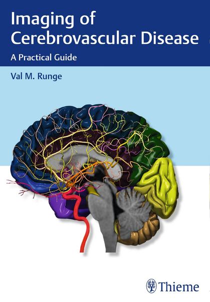 Produktbild: Imaging of Cerebrovascular Disease