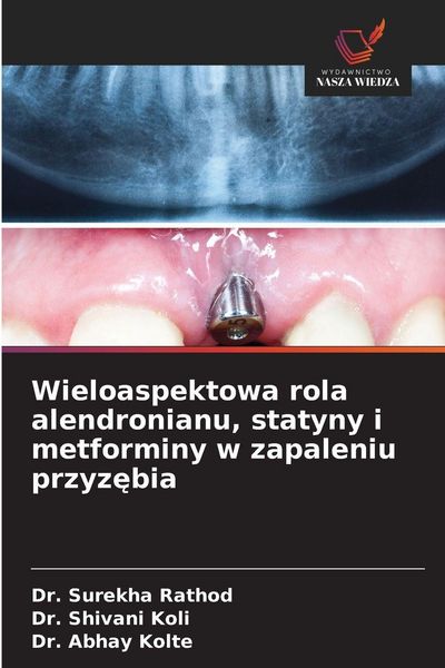 Produktbild: Wieloaspektowa rola alendronianu, statyny i metforminy w zapaleniu przyz&iquest;bia