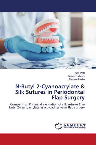 Produktbild: N-Butyl 2-Cyanoacrylate & Silk Sutures in Periodontal Flap Surgery