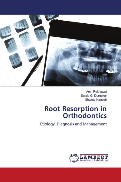 Produktbild: Root Resorption in Orthodontics