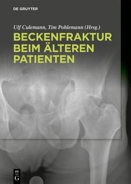 Produktbild: Beckenfraktur beim &auml;lteren Patienten