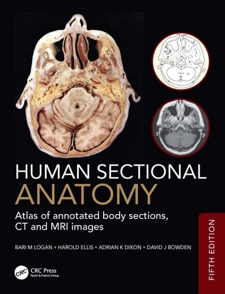 Produktbild: Human Sectional Anatomy