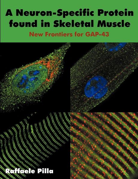 Produktbild: A Neuron-Specific Protein found in Skeletal Muscle