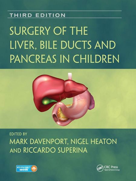 Produktbild: Surgery of the Liver, Bile Ducts and Pancreas in Children