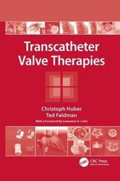 Produktbild: Huber, C: Transcatheter Valve Therapies