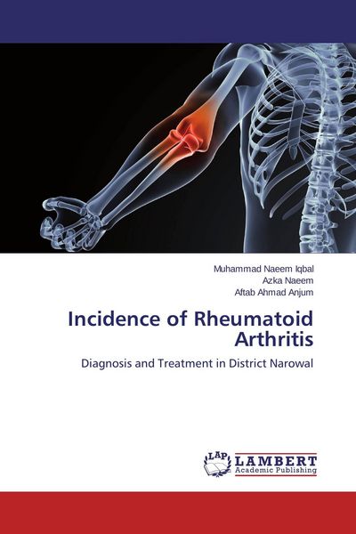 Produktbild: Incidence of Rheumatoid Arthritis
