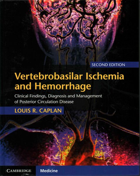 Produktbild: Vertebrobasilar Ischemia and Hemorrhage
