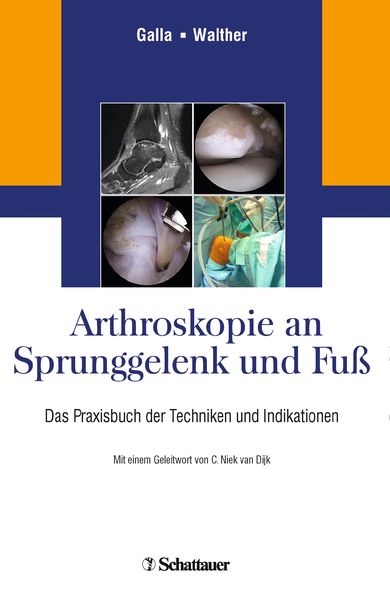 Produktbild: Arthroskopie an Sprunggelenk und Fu&szlig;