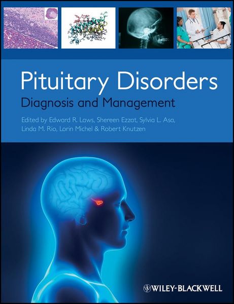 Produktbild: Pituitary Disorders