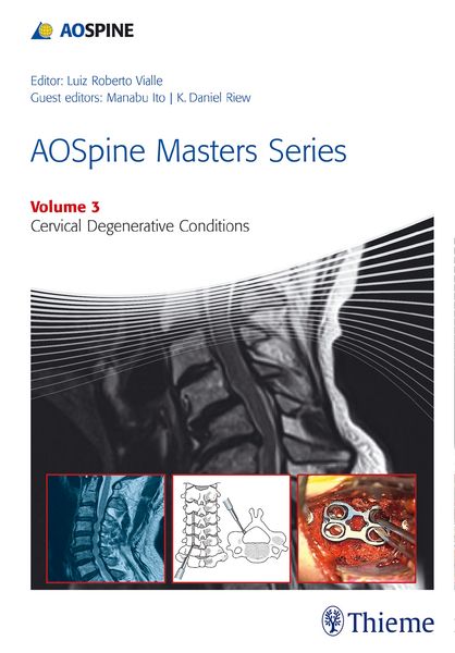 Produktbild: AOSpine Masters Series Volume 3: Cervical Degenerative Conditions