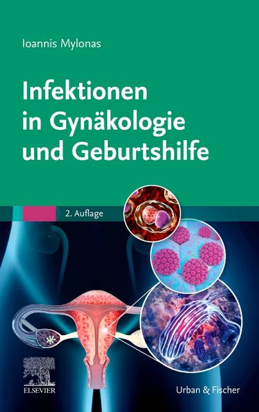Produktbild: Infektionen in Gyn&auml;kologie und Geburtshilfe