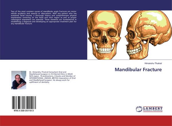 Produktbild: Mandibular Fracture