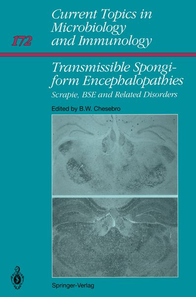 Produktbild: Transmissible Spongiform Encephalopathies: