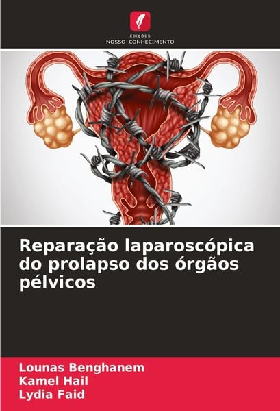 Produktbild: Repara&ccedil;&atilde;o laparosc&oacute;pica do prolapso dos &oacute;rg&atilde;os p&eacute;lvicos