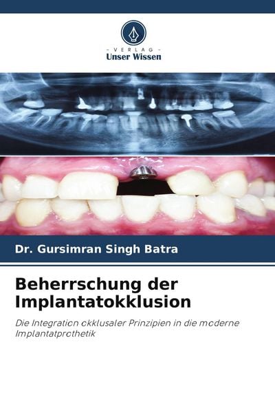 Produktbild: Beherrschung der Implantatokklusion