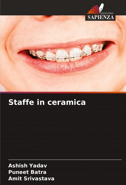 Produktbild: Staffe in ceramica