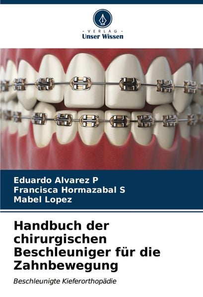 Produktbild: Handbuch der chirurgischen Beschleuniger f&uuml;r die Zahnbewegung