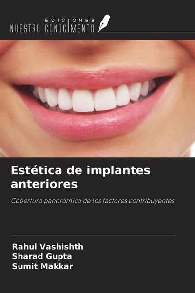 Produktbild: Est&eacute;tica de implantes anteriores