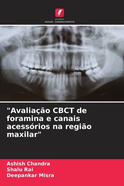 Produktbild: "Avalia&ccedil;&atilde;o CBCT de foramina e canais acess&oacute;rios na regi&atilde;o maxilar"