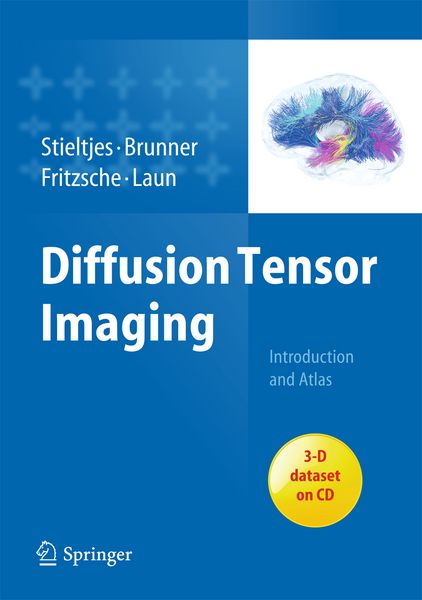 Produktbild: Diffusion Tensor Imaging