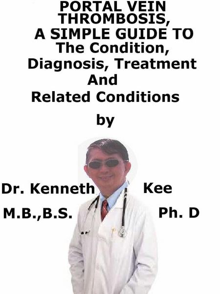 Produktbild: Portal Vein Thrombosis, A Simple Guide To The Condition, Diagnosis, Treatment And Related Conditions