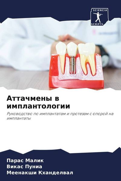 Produktbild: Attachmeny w implantologii