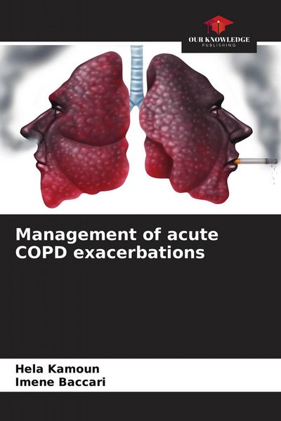 Produktbild: Management of acute COPD exacerbations