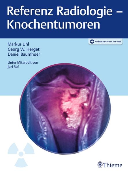 Produktbild: Referenz Radiologie - Knochentumoren