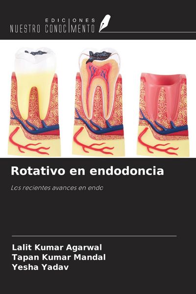 Produktbild: Rotativo en endodoncia