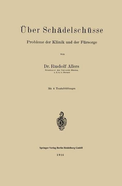 Produktbild: &Uuml;ber Sch&auml;delsch&uuml;sse