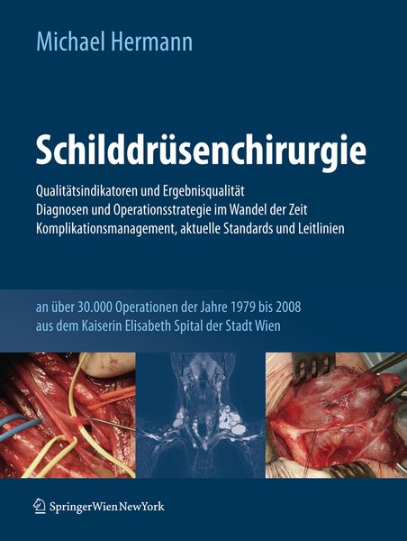Produktbild: Schilddr&uuml;senchirurgie - Qualit&auml;tsindikatoren und Ergebnisqualit&auml;t, Diagnosen und Operationsstrategie im Wandel der Zeit, Komplikationsmanagement, aktuelle Standards und Leitlinien