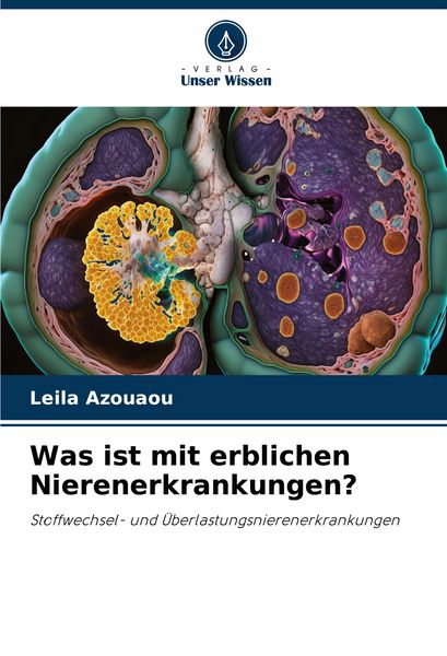 Was ist mit erblichen Nierenerkrankungen?, Taschenbuch von Leila Azouaou, Verlag Unser Wissen, 9786208633257