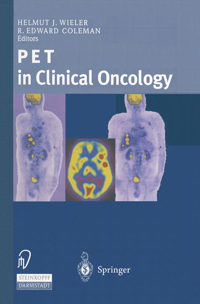 Produktbild: PET in Clinical Oncology