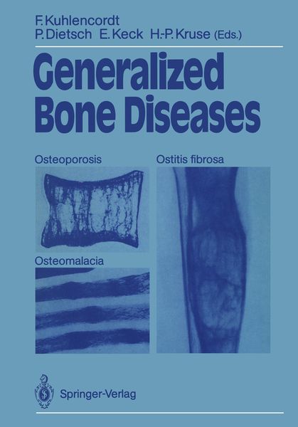 Produktbild: Generalized Bone Diseases
