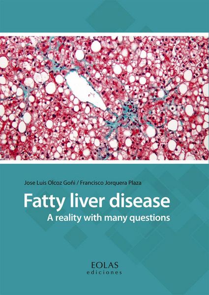 Produktbild: Fatty liver disease : a reality with many questions