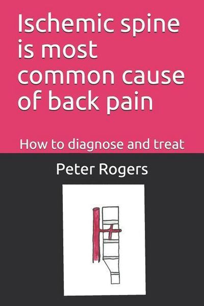 Produktbild: Ischemic Spine Is Most Common Cause of Back Pain: How to Diagnose and Treat