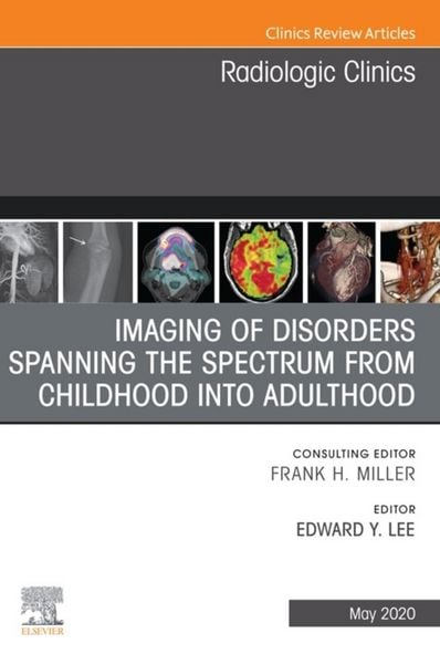 Produktbild: Imaging of Disorders Spanning the Spectrum from Childhood ,An Issue of Radiologic Clinics of North America E-Book