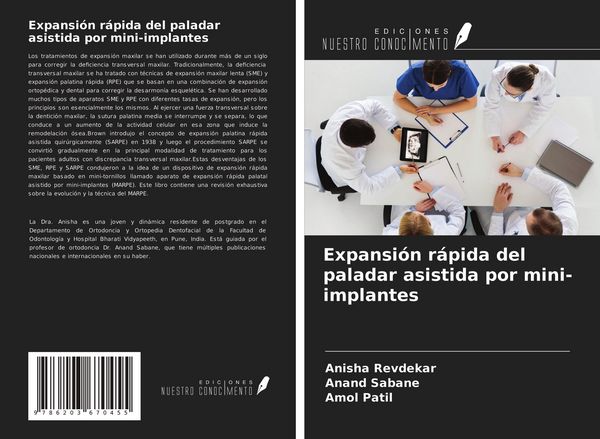 Produktbild: Expansi&oacute;n r&aacute;pida del paladar asistida por mini-implantes