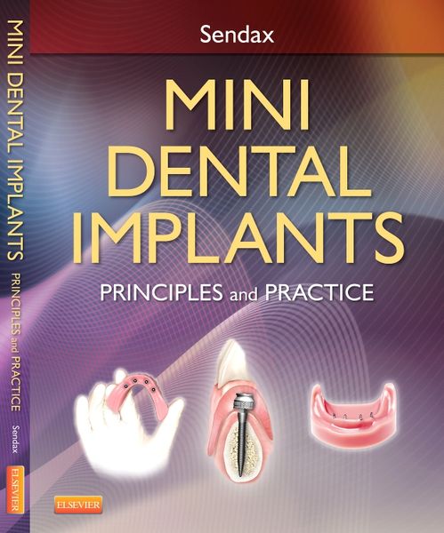 Produktbild: Mini Dental Implants