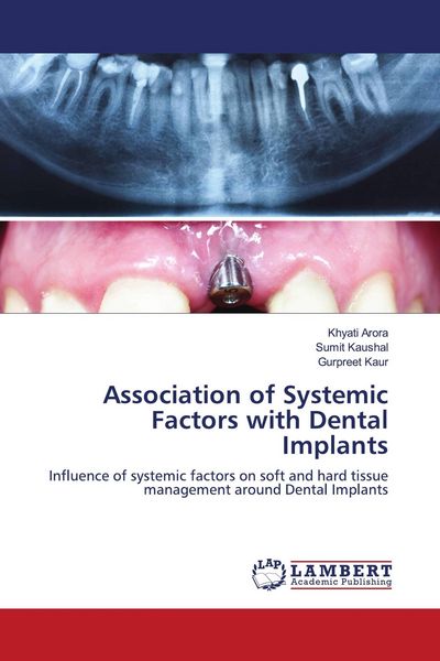 Produktbild: Association of Systemic Factors with Dental Implants