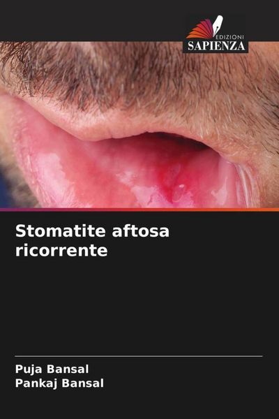 Produktbild: Stomatite aftosa ricorrente