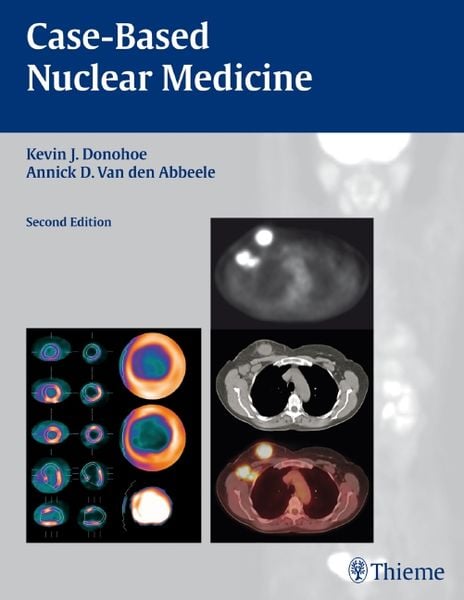 Case-Based Nuclear Medicine