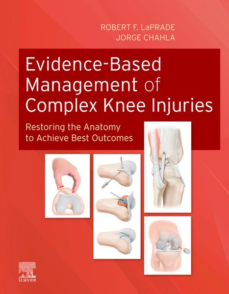 Produktbild: Evidence-Based Management of Complex Knee Injuries E-Book