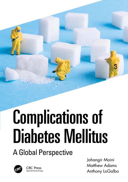 Produktbild: Complications of Diabetes Mellitus