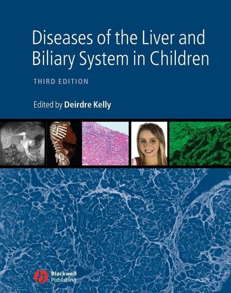 Produktbild: Diseases of the Liver and Biliary System in Children